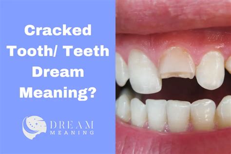  The Symbolic Meaning of a Swollen Tooth in a Dream 