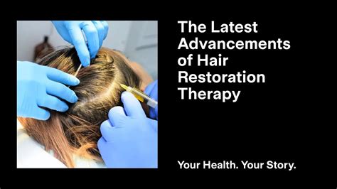 Advancements in Hair Rejuvenation: Where Science Meets Aspirations