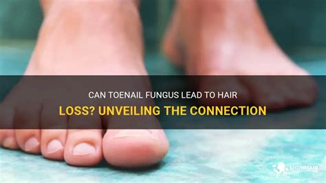 An Unusual Phenomenon: Exploring the Connection Between Dreams and Toenail Hair Development