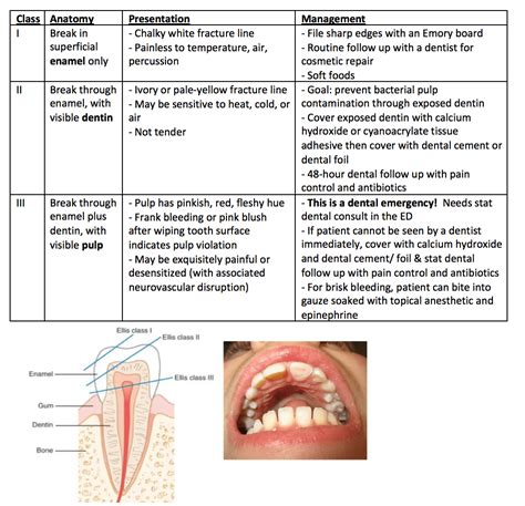 Common Emotions Associated with Dreams of Dental Fracture