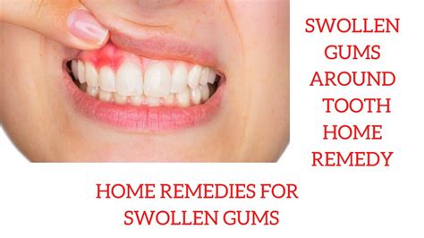 Coping with Swollen Tooth Dreams: Remedies and Techniques