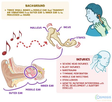 Decoding the Enigmatic Presence in Your Ear