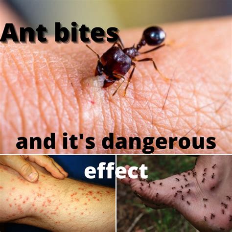 Decoding the Hidden Messages Behind Ant Bites