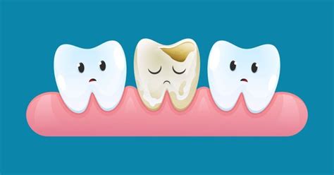 Dental Nightmares: Understanding Dreams about Cracked Teeth