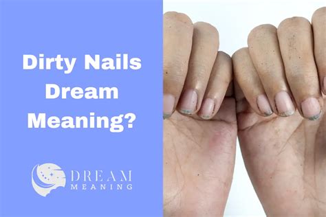 Dirty or Infected Nails in Dreams: Exploring Hidden Meanings