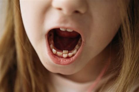 Dreams of Teeth Growing: What They Symbolize and How to Decipher Their Meaning