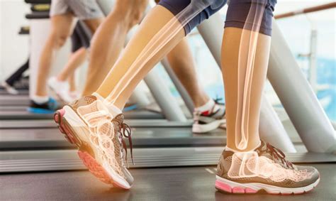 Enhancing Bone Health Through Physical Activity