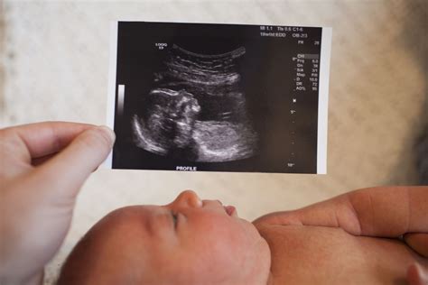 Exploring the Intriguing Details Concealed within Fetal Sonograms