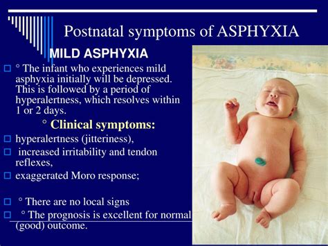 Exploring the Potential Origins of Infant Asphyxiation Nightmares