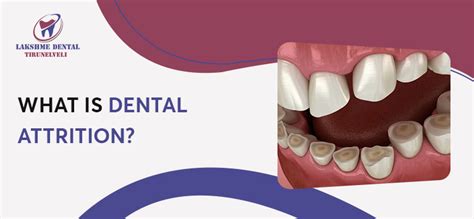 Exploring the Psychological Significance of Dental Attrition and Regeneration