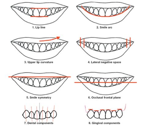 Exploring the Relationship between Teeth Alignment and Self-confidence