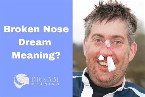 Exploring the Symbolism Surrounding a Fractured Nose in Dream World