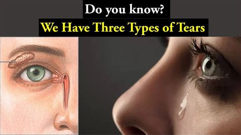 Exploring the Various Types of Tears in Dreams