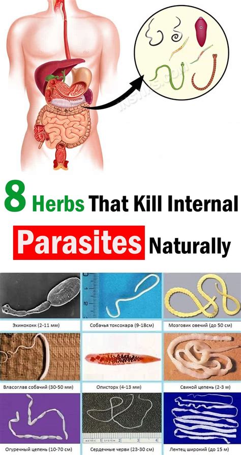 Home Remedies: Natural Ways to Eliminate Intestinal Parasites
