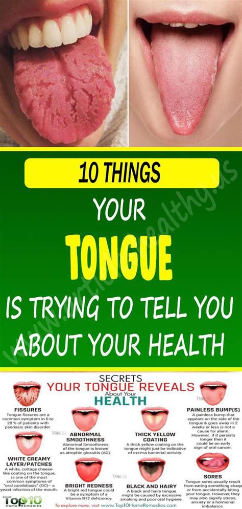 Home Remedies for Alleviating Tongue Swelling