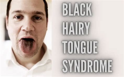 Insights for Decoding the Message: Understanding Your Tongue Hair Dreams