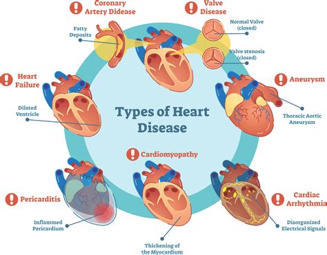 Mechanisms: The Influence of Dreams on Cardiac Health