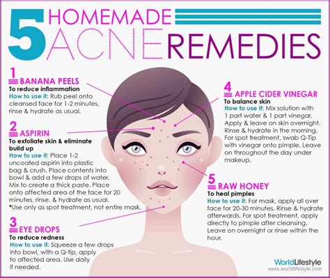 Natural Remedies for Acne-Free Skin - Bid Farewell to Breakouts