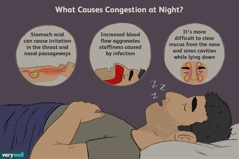Practical Measures to Prevent Reoccurring Episodes of Bleeding in the Throat While Sleeping