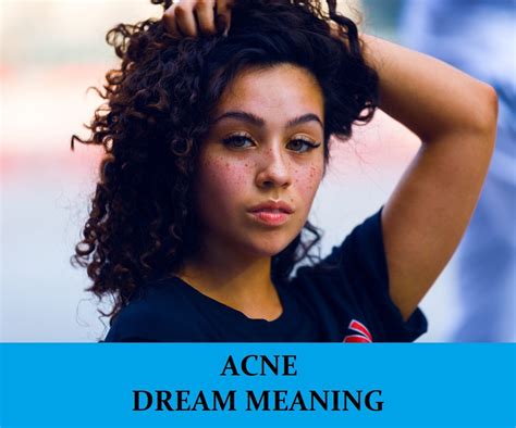 Psychological Explanations for Dreams Involving the Presence of Acne