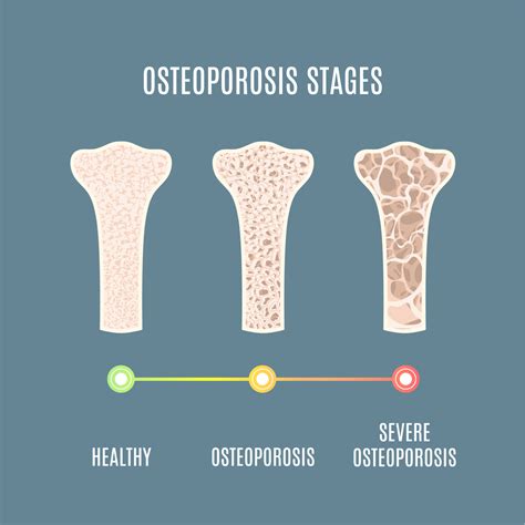 Strengthens Bones and Muscles, Preventing Osteoporosis and Frailty