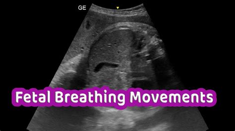 The Enchanting Connection: Significance Behind the Sensation of Fetal Movement