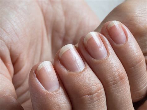 The Impact of Anxiety in Dreams about Detaching Manicured Nails