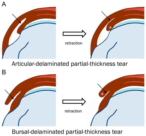The Intricate Link between Motion and Tears: Unveiling the Concealed Significance