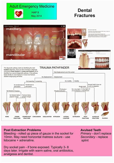 The Link Between Dreams of Dental Fractures and Anxiety over Loss