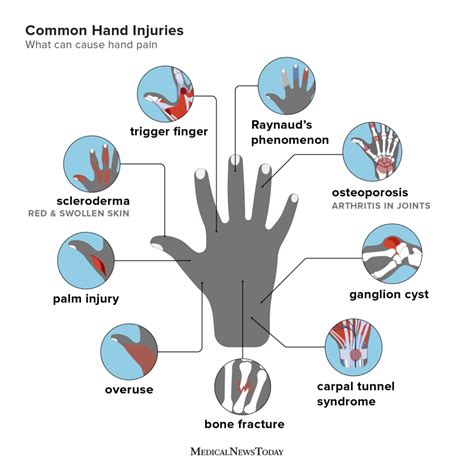 The Meaning Behind a Injury on the Left Side of the Palm