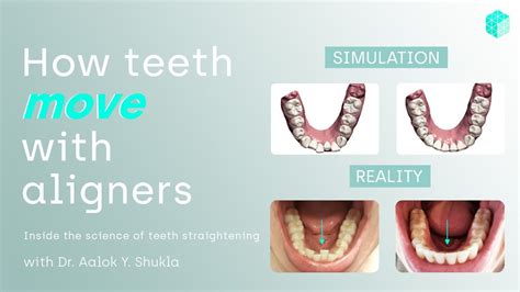 The Mysterious Shifting of Dental Alignment in Subconscious Reverie