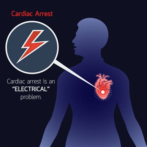 The Significance of Dreaming about Cardiac Arrest