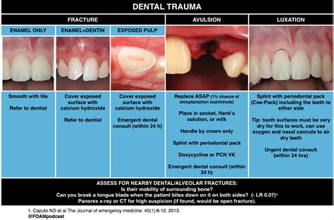 The Symbolic Interpretations of Dental Fracture in Dreams