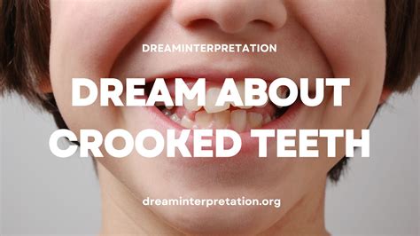 The Symbolic Meaning behind Dreams about Misaligned Teeth