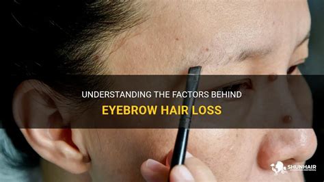 Troublesome Eyebrows: Understanding the Factors and Seeking Remedies