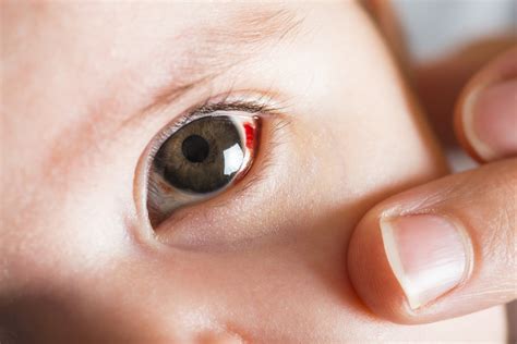 Uncovering the Emotional Impact: How Infant Ocular Hemorrhage Affects Our Subconscious