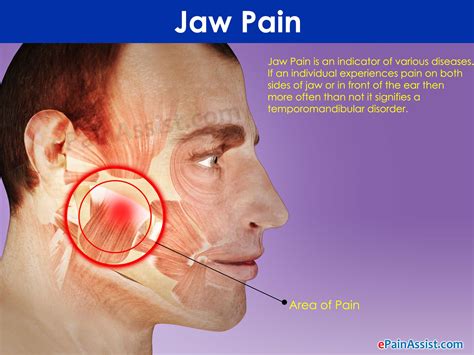 Understanding Jaw Swelling: An Overview