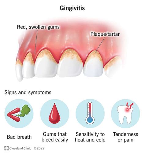 Understanding the Causes and Symptoms of Inflamed Gums