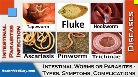 Understanding the Impact of Various Intestinal Parasites on the Human Body