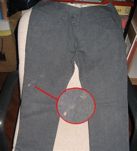 Understanding the Psychology behind Dreams about Stained Trousers