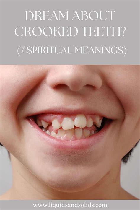 Unraveling the Symbolic Significance of Dreams Portraying Misaligned Teeth